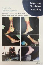 Image shows an improvement in circulation and healing for our client Image shows an improvement in circulation and healing for our client